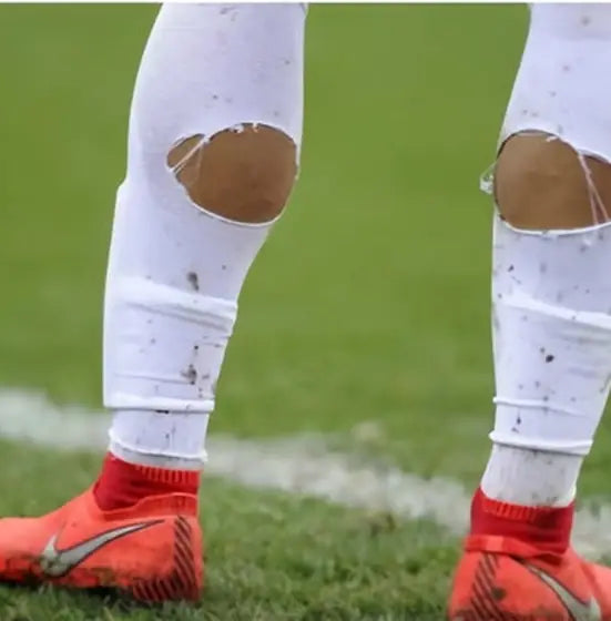 Matchday photo: footballer wearing socks with holes cut at the calf (case 03)