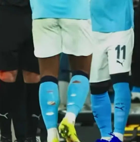 Matchday photo: footballer wearing socks with holes cut at the calf (case 04)