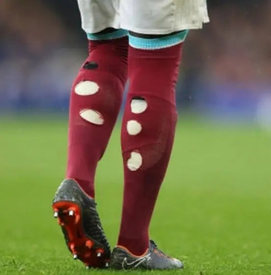 Matchday photo: footballer wearing socks with holes cut at the calf (case 06)