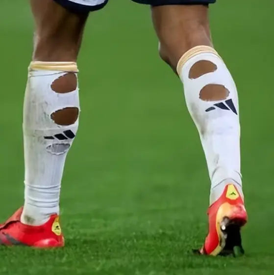 Matchday photo: footballer wearing socks with holes cut at the calf (case 07)