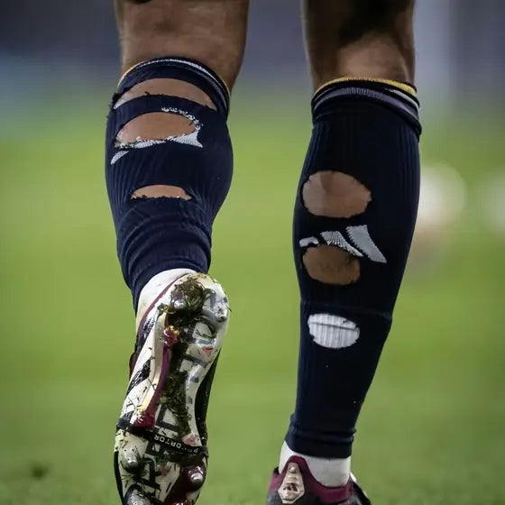 Matchday photo: footballer wearing socks with holes cut at the calf (case 11)