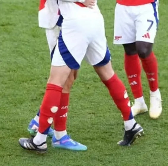 Matchday photo: footballer wearing socks with holes cut at the calf (case 14)