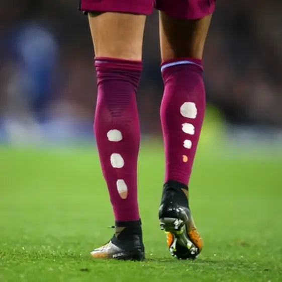 Matchday photo: footballer wearing socks with holes cut at the calf (case 19)