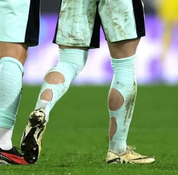 Matchday photo: footballer wearing socks with holes cut at the calf (case 20)