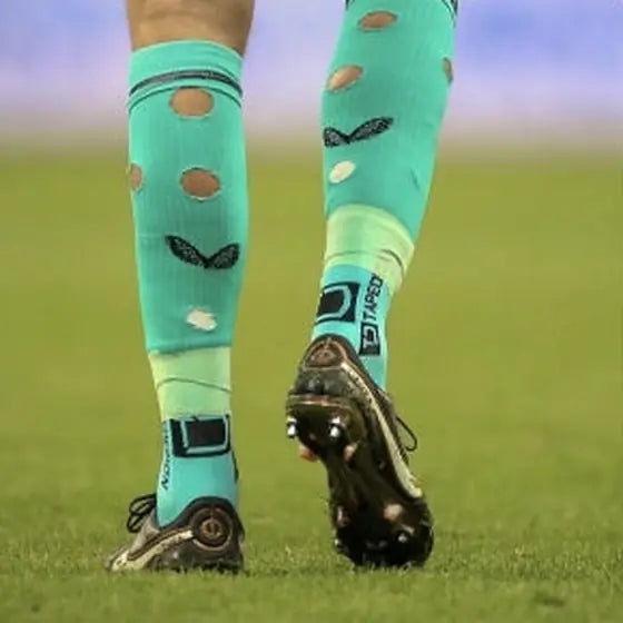 Matchday photo: footballer wearing socks with holes cut at the calf (case 22)