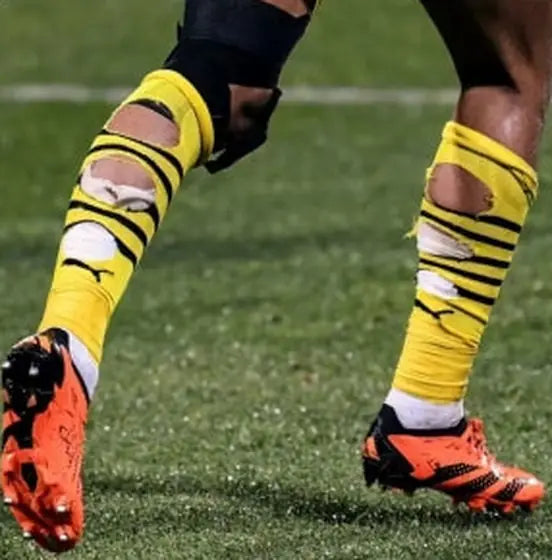 Matchday photo: footballer wearing socks with holes cut at the calf (case 24)