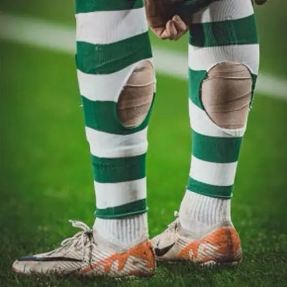 Matchday photo: footballer wearing socks with holes cut at the calf (case 26)