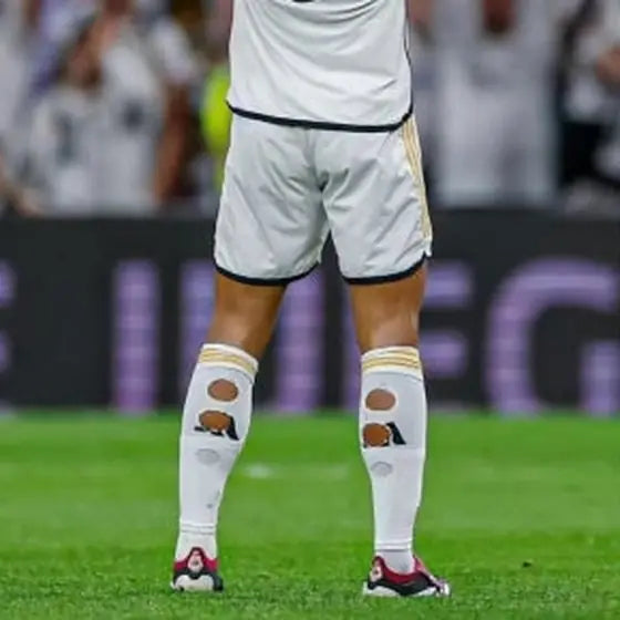 Matchday photo: footballer wearing socks with holes cut at the calf (case 02)