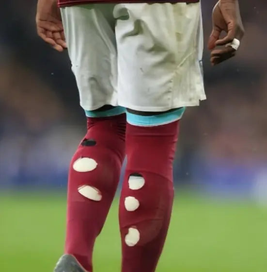 Matchday photo: footballer wearing socks with holes cut at the calf (case 05)