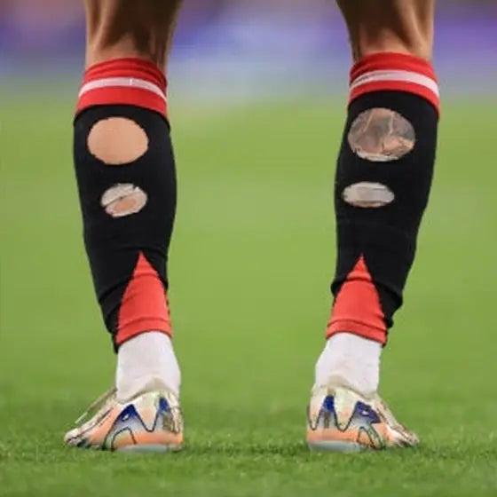 Matchday photo: footballer wearing socks with holes cut at the calf (case 08)