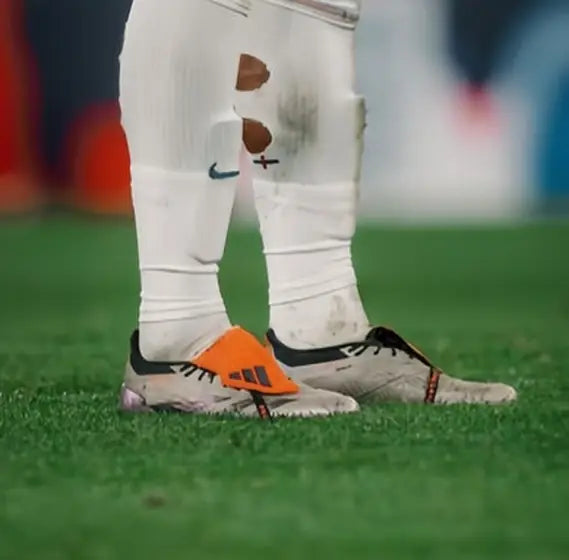 Matchday photo: footballer wearing socks with holes cut at the calf (case 09)