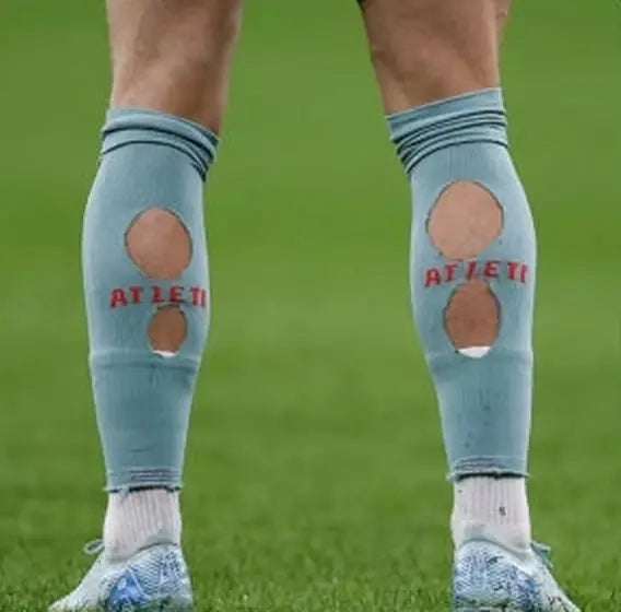 Matchday photo: footballer wearing socks with holes cut at the calf (case 10)