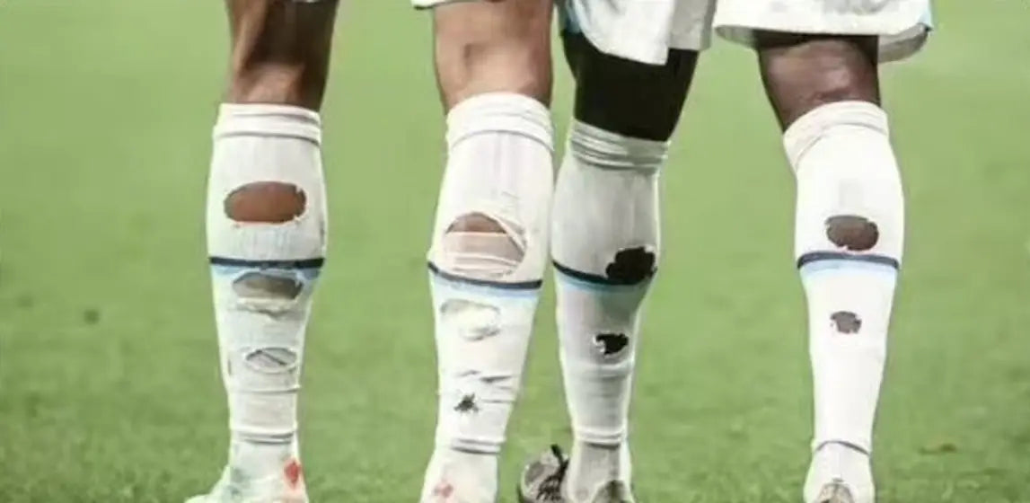 Matchday photo: footballer wearing socks with holes cut at the calf (case 12)