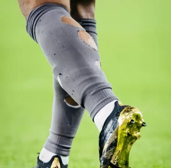 Matchday photo: footballer wearing socks with holes cut at the calf (case 15)