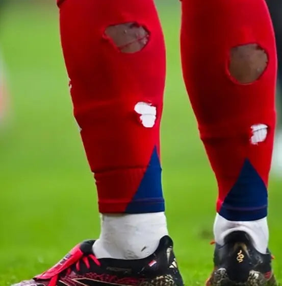 Matchday photo: footballer wearing socks with holes cut at the calf (case 21)
