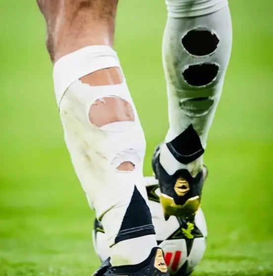 Matchday photo: footballer wearing socks with holes cut at the calf (case 23)